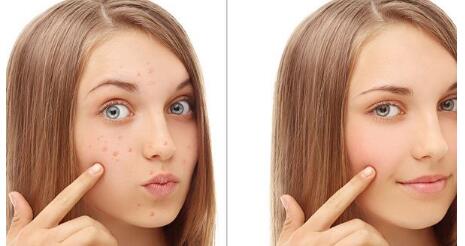 大連小切口拉皮手術(shù)價(jià)格表2023全新來襲(2023大連小切口拉皮手術(shù)參考價(jià)為：6174元)