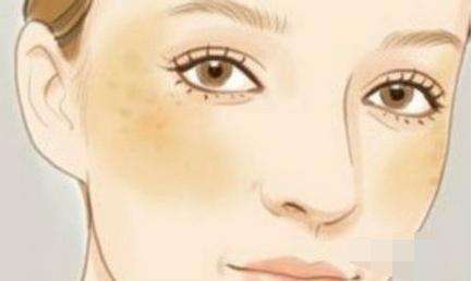 天津激光祛靜態(tài)紋的報(bào)價(jià)標(biāo)準(zhǔn)公開(kāi)(2023天津激光祛靜態(tài)紋參考價(jià)為：5470元)