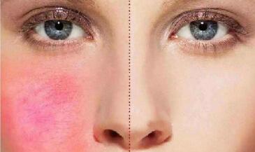 東莞注射縮鼻頭大致價格(2023東莞注射縮鼻頭參考價為：6569元)