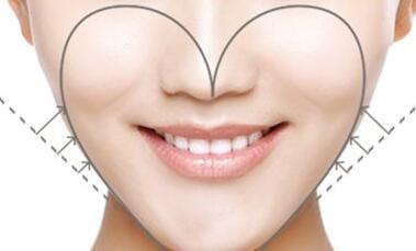 銀川激光祛法令紋治療費(fèi)用表清單上線(2023銀川激光祛法令紋參考價為：5793元)