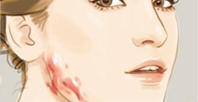 鄭州填補(bǔ)淚溝2023費(fèi)用信息更新發(fā)布(2023鄭州填補(bǔ)淚溝參考價(jià)為：6565元)