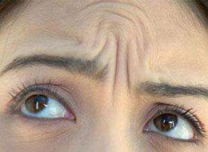 昆明激光去除額頭紋價目表清單一覽(2023昆明激光去除額頭紋參考價為：6962元)