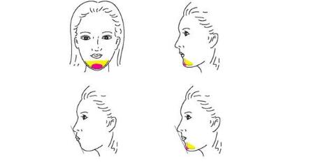 漢中玻尿酸打肥胖紋2023價格表詳情一覽(2023漢中玻尿酸打肥胖紋參考價為：5373元)