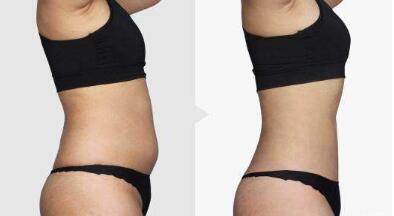 昆明頸部皺紋打玻尿酸手術費用表剖析(2023昆明頸部皺紋打玻尿酸參考價為：5328元)