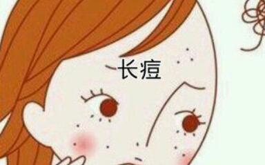 鄭州彩光嫩膚祛痘大約價(jià)位是多少(2023鄭州彩光嫩膚祛痘參考價(jià)為：6567元)