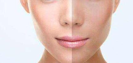 杭州祛除眶下皺紋價格表均價公布(2023杭州祛除眶下皺紋參考價為：6204元)