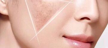 上海眼部皺紋整形大概費用是多少呢(2023上海眼部皺紋整形參考價為：5084元)