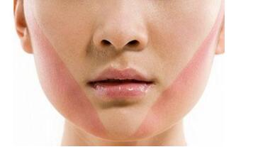 上海消除皮膚皺紋價格