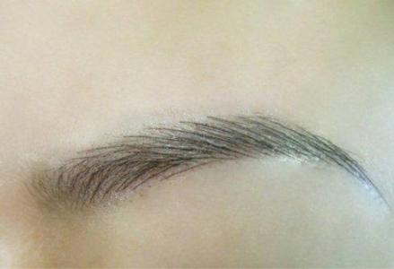 烏魯木齊線雕去除川字紋治療價格明細一覽(2023烏魯木齊線雕去除川字紋參考價為：5988元)