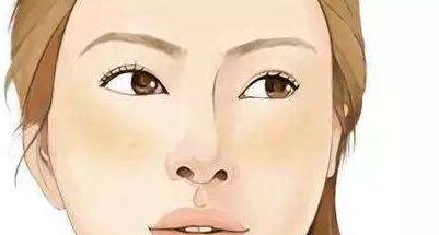 廈門手術消除面部皺紋價目表(費用明細)(2023廈門手術消除面部皺紋參考價為：6819元)