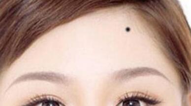 溫嶺愛貝芙祛除抬頭紋一般多少費(fèi)用(2023溫嶺愛貝芙祛除抬頭紋參考價為：7497元)