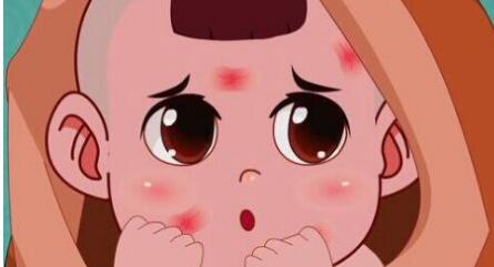 云南激光祛紅血絲價(jià)格大概是多少啊(2023云南激光祛紅血絲參考價(jià)為：7227元)