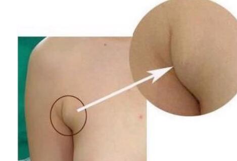 沈陽(yáng)手術(shù)祛除眉間紋價(jià)目表明細(xì)查詢(2023沈陽(yáng)手術(shù)祛除眉間紋參考價(jià)為：6876元)