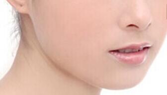 鄭州鼻翼溝整形治療價(jià)目表曝光(2023鄭州鼻翼溝整形參考價(jià)為：7599元)