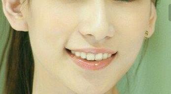 深圳納米光波去咖啡斑的費用明細公開(2023深圳納米光波去咖啡斑參考價為：6804元)