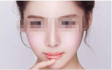 深圳注射填充祛頸紋2023優(yōu)惠價格一覽表(深圳民生婦科醫(yī)院整形美容中心注射填充祛頸紋參考價：3697元)