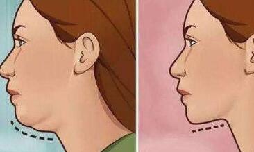 重慶激光皮膚磨削去疤痕價(jià)格