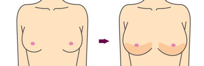 濰坊botox瘦手臂價(jià)格表均價(jià)一覽(濰坊還幼醫(yī)療美容botox瘦手臂參考價(jià)：5386元)