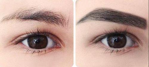 杭州面部提拉埋線(xiàn)2023收費(fèi)明細(xì)一覽表(杭州三醫(yī)院整形美容科面部提拉埋線(xiàn)參考價(jià)：4258元)