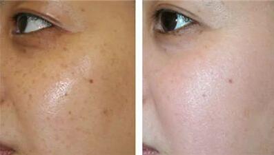 重慶面部敏感肌價(jià)格