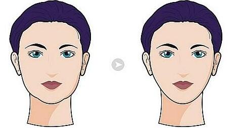 寧波微針去除唇紋整形價(jià)格表對(duì)比(寧波李惠利醫(yī)院皮膚美容科微針去除唇紋參考價(jià)：5936元)