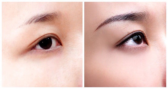 北京6S急速溶脂瘦身價(jià)格表收費(fèi)目錄一覽(北京京韓整形醫(yī)院6S急速溶脂瘦身參考價(jià)：6543元)