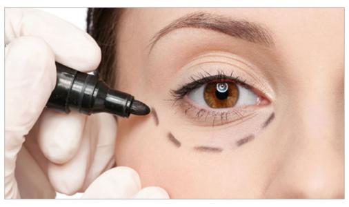 廣州脂肪填充頸脖紋價格