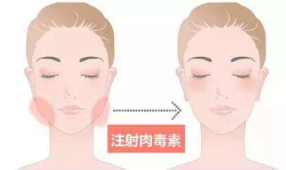 舟山背部吸脂需要花多少費用(舟山港東醫(yī)療美容診所背部吸脂參考價：3652元)