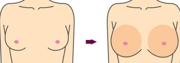 昆明光子去除老年斑價(jià)格2023明細(xì)上線(昆明前衛(wèi)美眼醫(yī)療美容診所光子去除老年斑參考價(jià)：3739元)