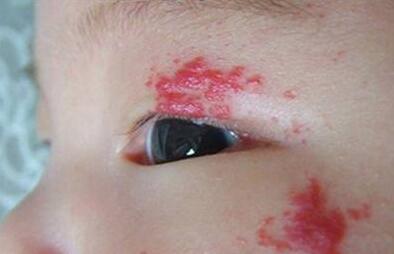 大連秒雕祛額頭紋2023收費(fèi)標(biāo)準(zhǔn)更新(大連張躍年醫(yī)療美容整形診所秒雕祛額頭紋參考價(jià)：3512元)