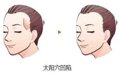 宜賓微創(chuàng)貫穿雙眼皮整形價(jià)目表查看(宜賓貞尚醫(yī)療美容診所微創(chuàng)貫穿雙眼皮參考價(jià)：6709元)