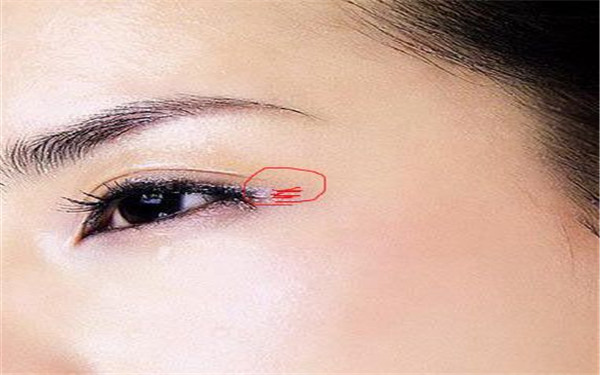 青海墊下巴美容一次通常要花費(fèi)多少錢(青海大學(xué)附屬醫(yī)院墊下巴美容參考價(jià)：3098元)