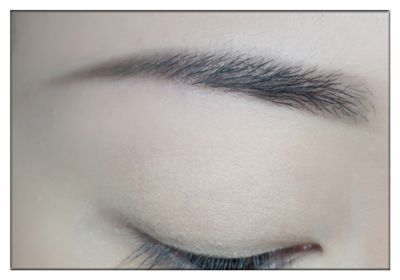 運城干細(xì)胞祛除口周紋一次治療費用是多少(運城海鷗美容外科診所干細(xì)胞祛除口周紋參考價：4809元)