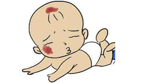 重慶線雕去除眼紋收費(fèi)價(jià)格表2023參考(重慶南岸區(qū)中西醫(yī)結(jié)合醫(yī)院整形科線雕去除眼紋參考價(jià)：5088元)