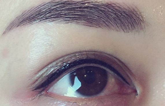 淄博射頻點陣激光祛疤痕費用大致多少(淄博德美醫(yī)療美容診所射頻點陣激光祛疤痕參考價：6497元)