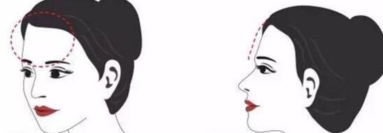 廣州精雕祛魚尾紋價(jià)格表2023版上線(廣州HJR韓佳人網(wǎng)紅整形美容門診部精雕祛魚尾紋參考價(jià)：5106元)