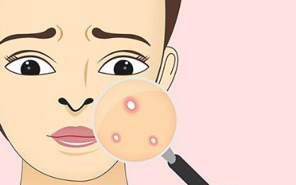 武漢激光祛除魚尾紋的價錢大概要多少錢啊(湖北武漢大學(xué)人民醫(yī)院整形科激光祛除魚尾紋參考價：3220元)