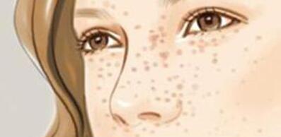 襄陽微雕去頸紋手術(shù)價格一覽(襄陽眾美醫(yī)療美容門診部微雕去頸紋參考價：3622元)