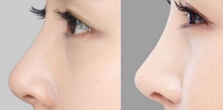 南通做光子美白手術價格(南通第三人民醫(yī)院做光子美白參考價：4392元)