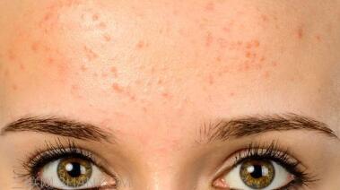 徐州川字紋注射治療價(jià)目表剖析(徐州礦業(yè)集團(tuán)總醫(yī)院川字紋注射參考價(jià)：4592元)