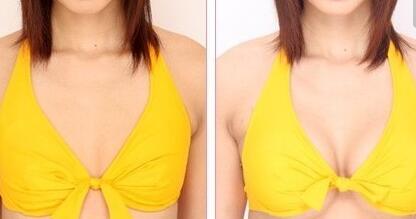 福州射頻妊娠紋價格表一覽表(福州醫(yī)科大學附屬福州第一醫(yī)院整形科射頻妊娠紋參考價：5582元)