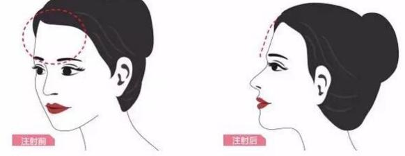 長沙鼻缺損修復再造大致價格表參考(長沙梵汐醫(yī)療美容門診部鼻缺損修復再造參考價：3749元)