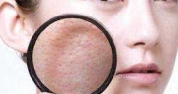 麗水大拉皮去皺一次大概要花多少錢(麗水莊莉醫(yī)療美容診所大拉皮去皺參考價(jià)：6584元)