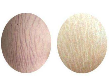 南昌下頜角微調(diào)價格呢(南昌大學第四附屬醫(yī)院整形外科下頜角微調(diào)參考價：3039元)