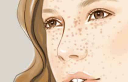 云南微創(chuàng)割雙眼皮費用貴不貴(云南大學附屬醫(yī)院整形外科微創(chuàng)割雙眼皮參考價：5286元)