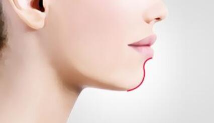 漳州臥蠶玻尿酸費(fèi)用需要花多少(漳州175醫(yī)院整形美容科臥蠶玻尿酸參考價(jià)：3235元)