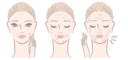 金華美雕祛皺紋價格表明細上線(浙江大學金華醫(yī)院整形美容中心美雕祛皺紋參考價：4861元)