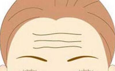 保定肉毒素去木偶紋價(jià)位明細(xì)(保定第一醫(yī)院肉毒素去木偶紋參考價(jià)：5236元)