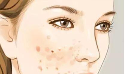 佛山射頻消融法去眼袋價(jià)格