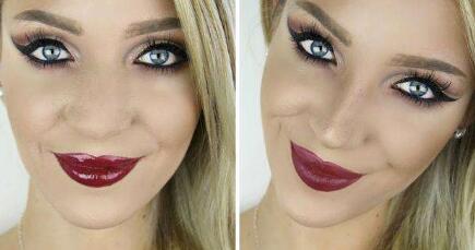 臺(tái)州肚皮松弛緊致價(jià)格